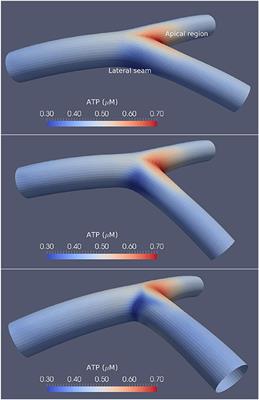 Coronary Smooth Muscle Cell Calcium Dynamics: Effects of Bifurcation Angle on Atheroprone Conditions